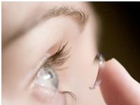 角膜塑形镜可有效控制近视加深